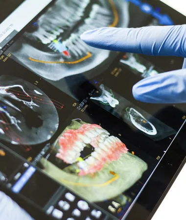 Vue 3D détaillée des dents, des mâchoires et de l'os, pour planifier chaque traitement avec précision et sécurité.
