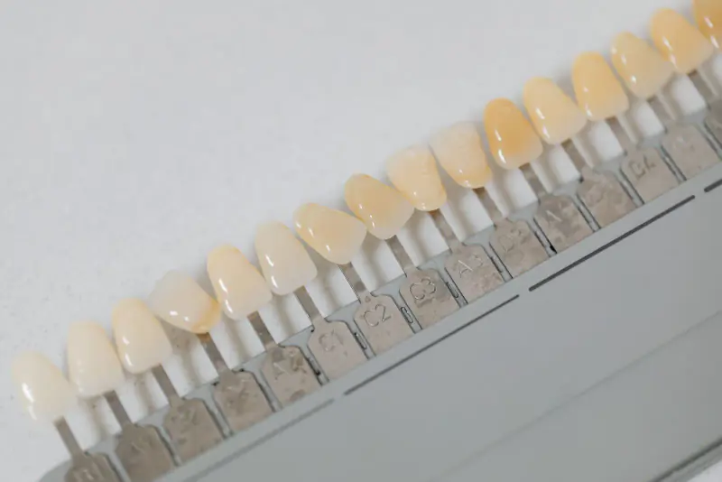 Teintier dentaire posé en diagonale sur une surface blanche, ses échantillons allant du blanc au jaune plus soutenu