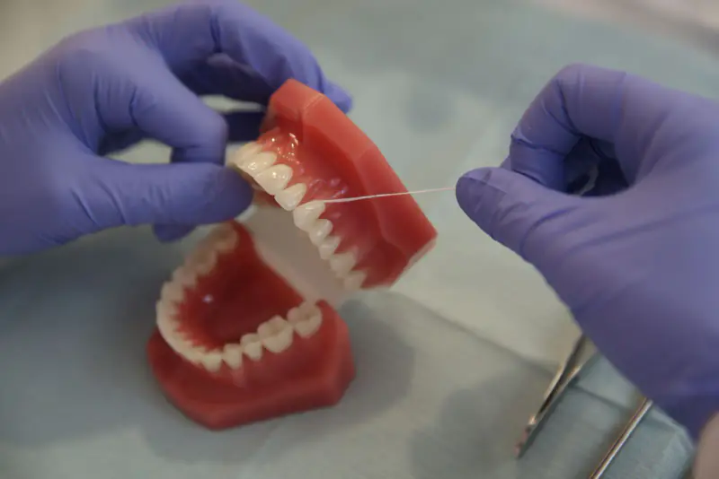 Mains gantées de violet passant un fil dentaire entre deux dents du haut d’un modèle de mâchoire ouvert, posé sur un champ clair