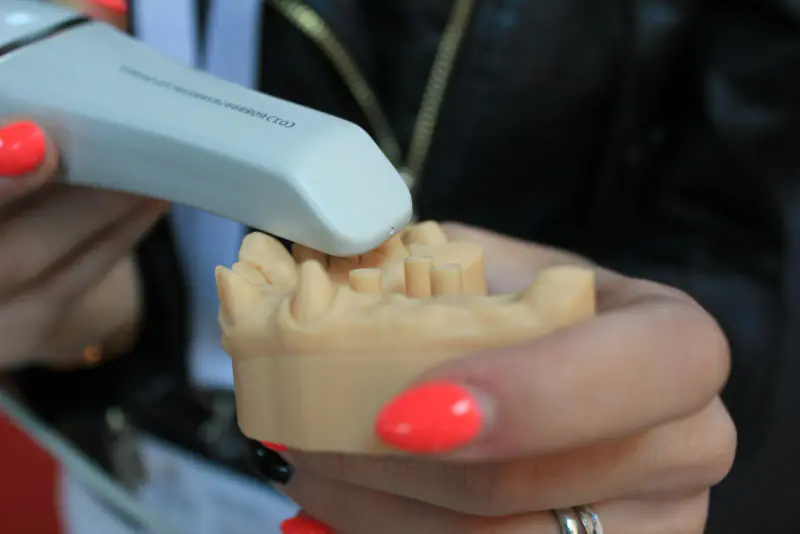 Scanner intra-oral numérisant un modèle d’arcade dentaire en plâtre tenu en main, pour illustrer l’empreinte numérique