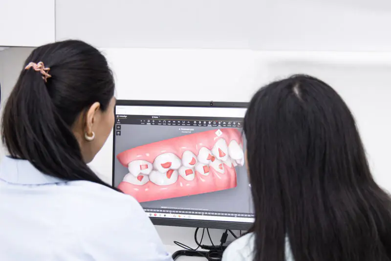 Deux femmes vues de dos, l’une en tunique bleu ciel, examinent à l’écran un modèle 3D des arcades dentaires avec des taquets orthodontiques