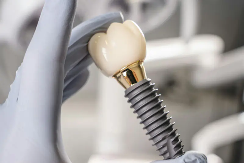 Main gantée tenant un implant dentaire en titane vissé à son pilier doré et à une couronne blanche, dans une salle de soins