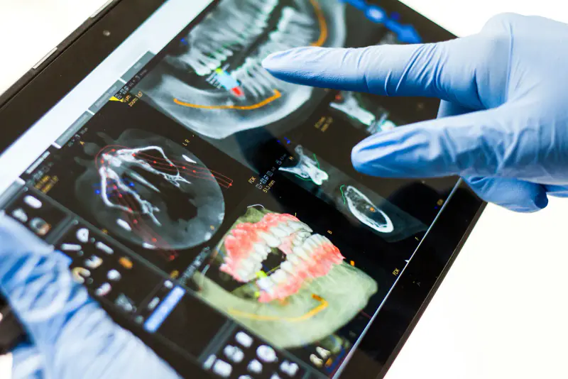 Main gantée désignant une reconstruction 3D de la mâchoire et des coupes d’imagerie sur l’écran d’une tablette