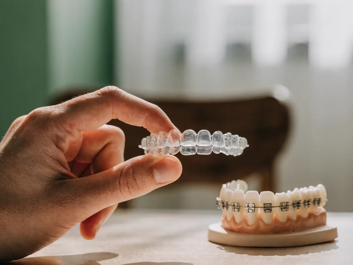 Bagues ou aligneurs invisibles : lequel choisir ?