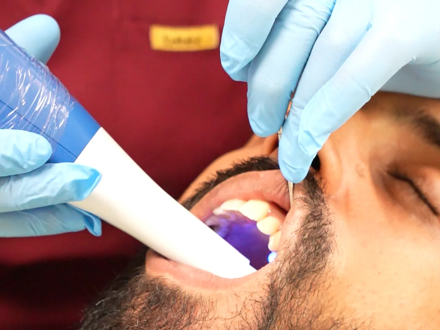 Intraoralscanner während der zahnärztlichen Untersuchung eines Patienten in der Praxis in Kénitra