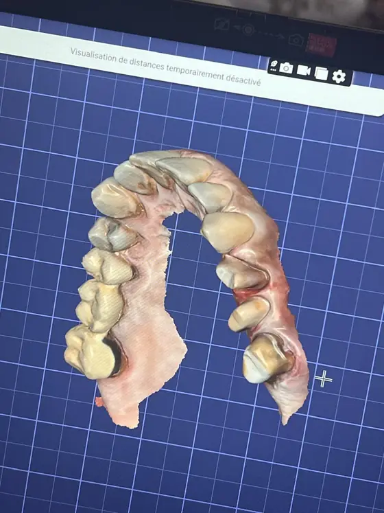 Digitales Modell eines Kiefers auf dem blauen Raster der Software, von oben gesehen, Zähne und Zahnfleisch volumetrisch rekonstruiert.