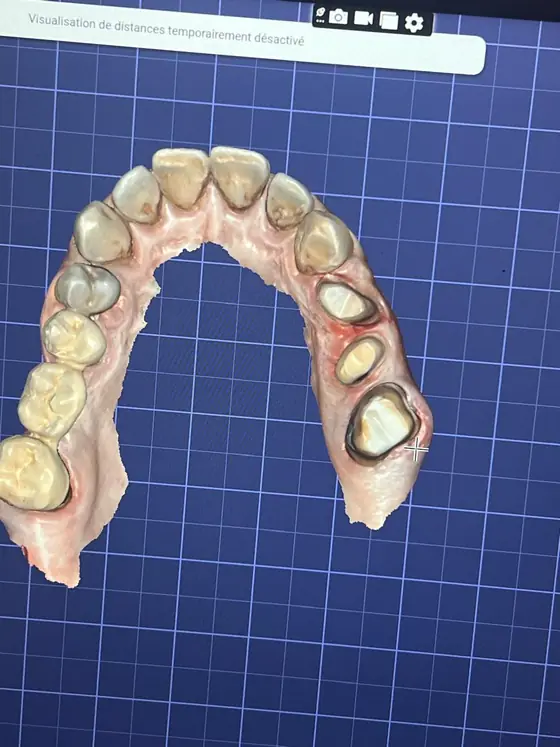 Das 3D-Modell im Konstruktionsprogramm auf einem blauen Messraster, mit der Analyse-Werkzeugleiste am oberen Fensterrand.