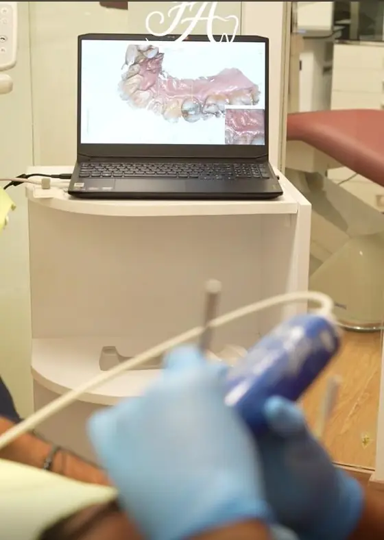 Behandschuhte Hand mit der blauen Sonde eines Intraoralscanners; dahinter zeigt ein Laptop auf der Behandlungseinheit den entstehenden 3D-Abdruck, rechts der Behandlungsstuhl.