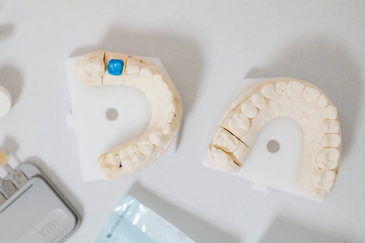 Moulages de dents en plâtre et outils de laboratoire