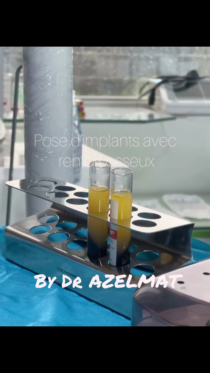 Tubes de préparation biologique sur un plateau avant une intervention au cabinet