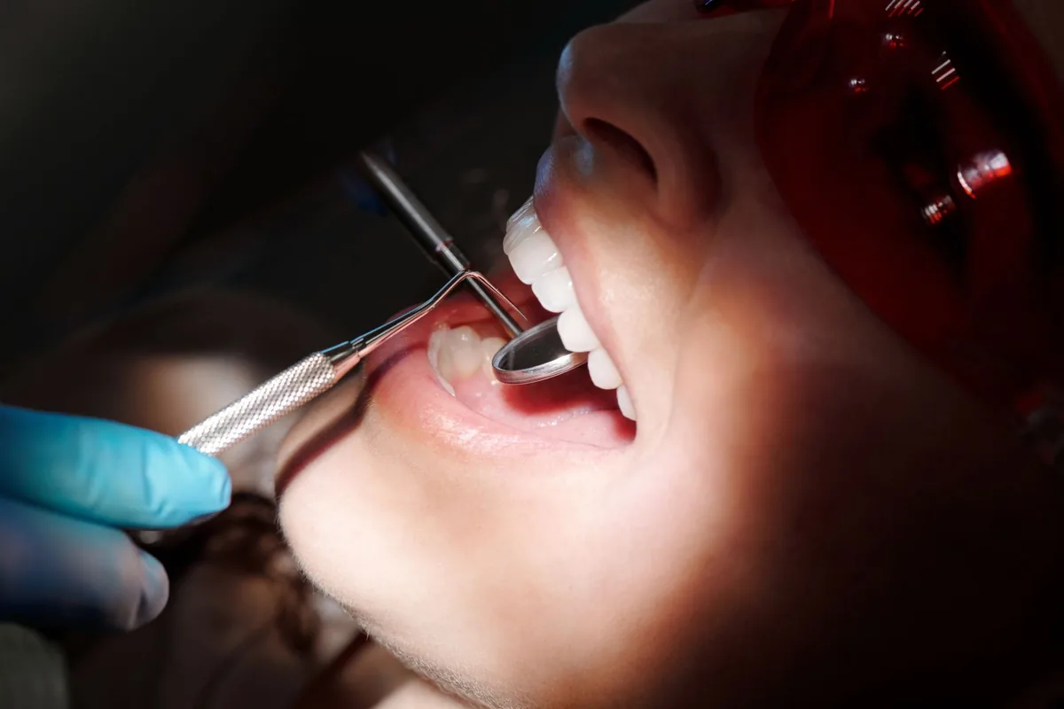 Examen de la bouche avec un miroir dentaire