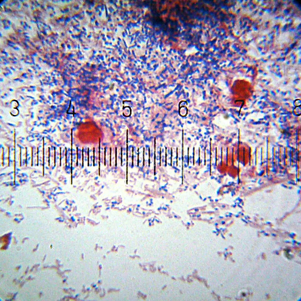 Plaque dentaire observée au microscope