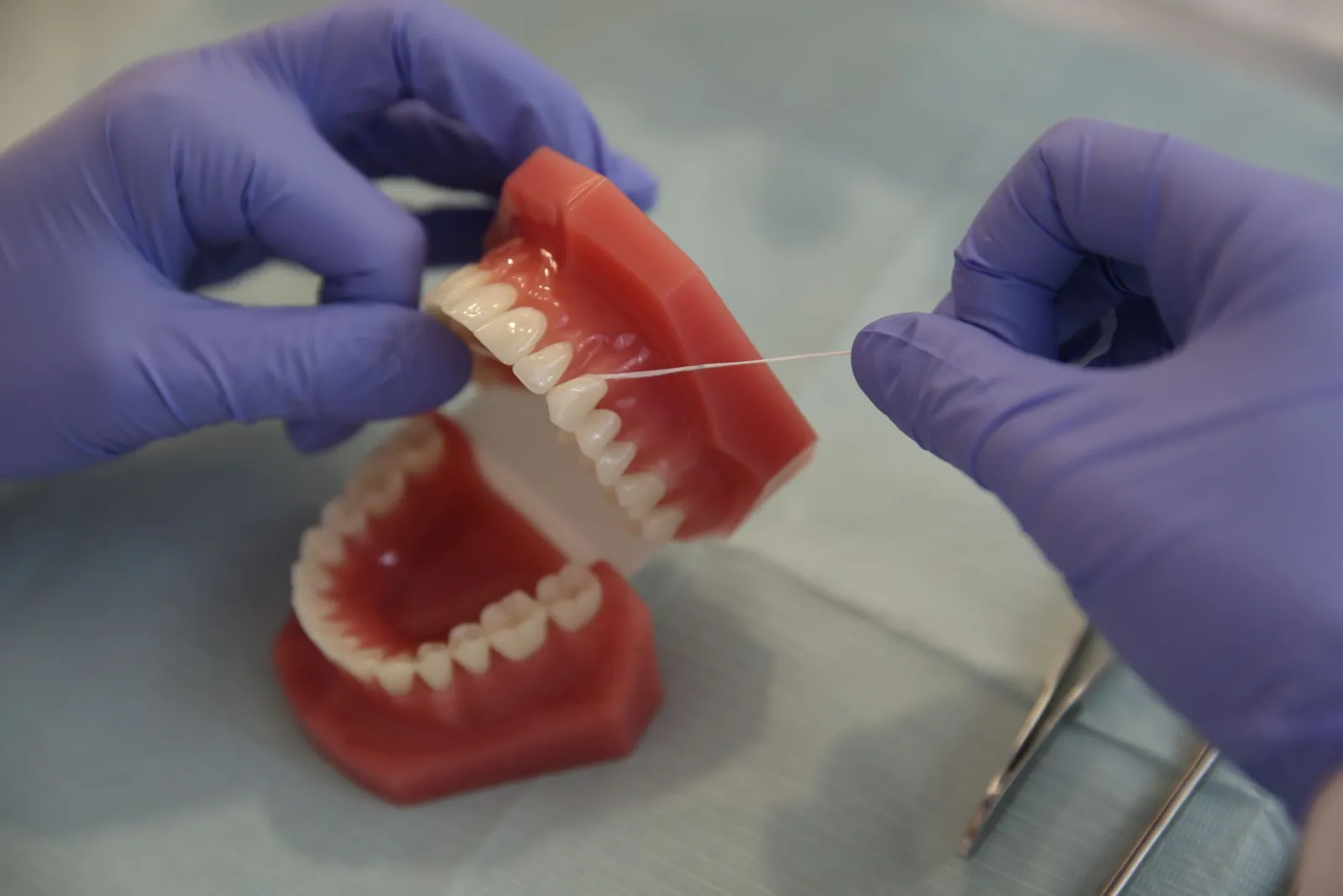 Mains gantées de violet passant un fil dentaire entre deux dents du haut d’un modèle de mâchoire ouvert, posé sur un champ clair