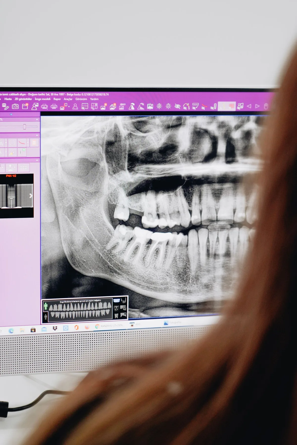 Consultation d’une radiographie panoramique sur écran