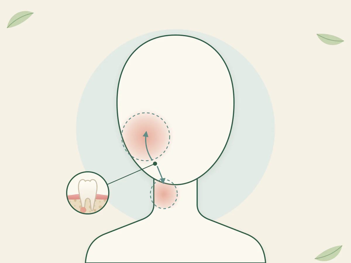 Silhouette de tête et de cou sans visage : une zone rosée sur le côté du visage et une autre sur le cou, reliées par des flèches à une dent du bas agrandie dans un cercle.
